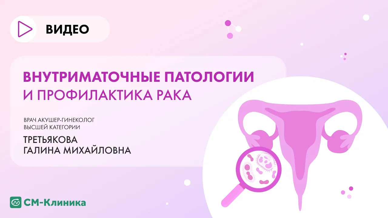 Скрытая камера у гинеколога  